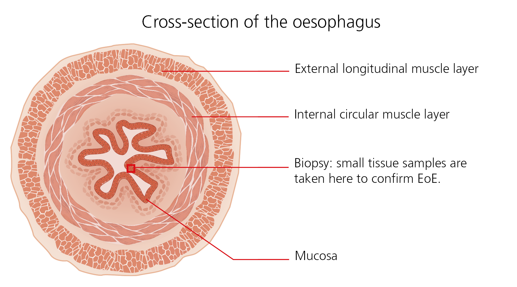 Cross-section of the oesophagus